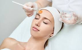 Chemical Peels
