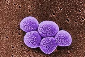 The affected area might be: Study Superbug Mrsa Infection Eurekalert Science News Releases