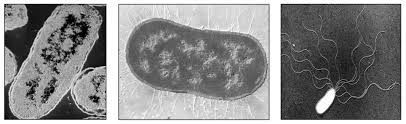 Some of these differences can be clearly understood when the cells are examined under an electron microscope. Cell Micrographs Bioninja