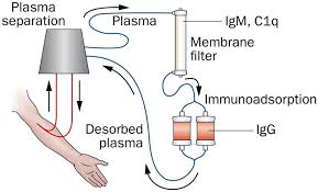 Immunoadsorption combined with membrane filtration might enhance  desensitization | Nature Reviews Nephrology