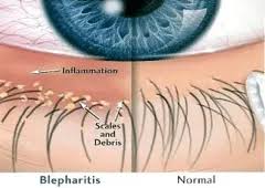 Image result for Blepharis affinis