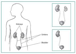 I am in stage 4 kidney disease and can't have a transplant. Solitary Or Single Functioning Kidney Niddk