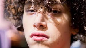 However, some people develop symptoms where they have this skin cancer. This Dude Popped A Zit And It Turned Into A Tumor Stylecaster