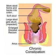 Pin On Stomach