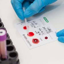 Acestea ofera medicului informatii cu privire la sistemul tau imunitar, ajuta la depistarea totodata, cu ajutorul analizelor de sange, pot fi descoperite anumite carente sau malformatii congenitale. Laborator Analize Turda Clinic Med Diagnosis