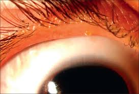 Image result for Blepharis inflata