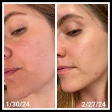 The Best 10 Skin Care near Herbal Nails & Spa in Lynnwood, WA