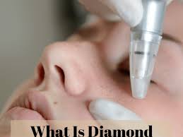 It is also important to note that they may charge an extra fee depending on how hard it is. The Benefits Of Diamond Microdermabrasion Bellatory