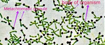 Image result for loeffler diphtheria volutin