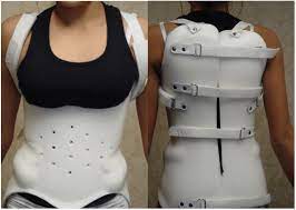 The brace helps to hold everything immobile while you are healing. Bracing For Back Braces Treatments For Spinal Injury Nj Nyc