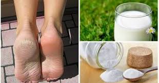 Comment Avoir Des Beaux Pieds Lisses Avec Ce Traitement Interessant Du Lait Et Du Bicarbonate De Sodium Dont L Beautiful Feet Make Beauty Natural Ingredients