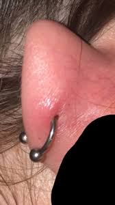 Mehrere helix piercings nebeneinander können außerdem zum hingucker werden. Was Ist Das An Meinem Helix Ohr Piercing Entzundung Helix Piercing