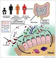 Image result for Clostridioides difficile