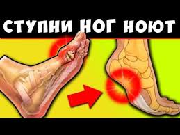 как избавиться от запаха на ногах в домашних условиях Pin Na Doske Zdorove