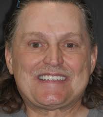 Rex Masters Obituary