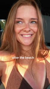 oh and a huge pimple appeared!