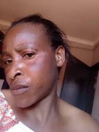 What can I use to remove dark spots?