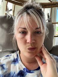 Everyone that will please pray for Lil Austin So Austin's eye wasn't  getting better so I took him to the doctor and I'm glad I did. He doesn't  have a stye. Austin