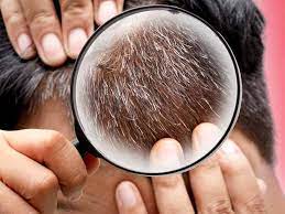 Using these remedies will not only help you to treat your hair fall but it will also make your hair strong. Home Remedies To Get Black Hair Naturally At Home Lifealth