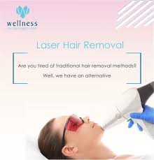 This is a modern method, which delivers nearly permanent results. Laser Hair Removal Are You Tired Of Waxing Tweezing And Commercial Hair Removal Creams An Alternative Can Be Cosmetic Surgery Laser Hair Removal Hair Removal