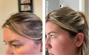 Poten-Cee + C's main ingredients are Hydrolyzed Collagen and Vitamin C.  Vitamin C helps with collagen production for healthy skin and hair. While  Hydrolyzed Collagen is an easily digestible and readily absorbed