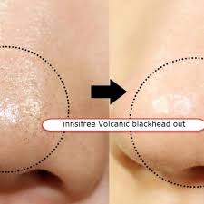 Melt the blackheads and create a shiny nose melt the blackhead with an oil massage deep cleansing for clean, clean skin when body temperature meets oil melting formulation the more you massage, the softer the oil changes gently. Jeju Blackhead Out Balm Makeup Beauty House