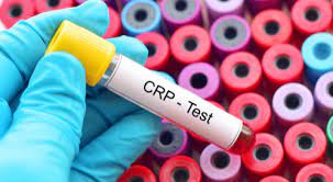 Therefore when titers are drawn they must be quantitative. Ù…Ø§ Ù‡Ùˆ ØªØ­Ù„ÙŠÙ„ Crp Ø¯Ù„ÙŠÙ„Ùƒ Ø§Ù„Ø´Ø§Ù…Ù„ ÙˆÙŠØ¨ Ø·Ø¨