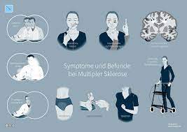 Multiple sklerose gehört zu den erkrankungen des nervensystems die langsam und schleichend ihre destruktive wirkung zeigt. Multiple Sklerose Wikipedia