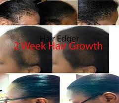 This ancient method of extracting oil first began in jamaica, thus, it gained the name jamaican castor oil. Jamaican Black Castor Oil Extream Hair Growth On Popscreen