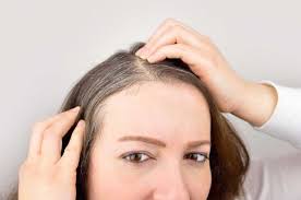 Pour mixture into a water bottle and spray the hair until it is saturated. Top 6 Home Remedies To Treat Premature Grey Hair
