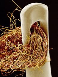 Check spelling or type a new query. This Is The Eye Of The Needle Thread With Red Cotton Under Electron Microscope 9gag