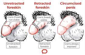 It's not a sexually transmitted disease either. How Do I Clean My Penis