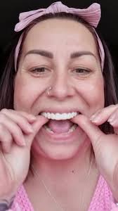 Embracing change and covering the gap! 🌟 Gemma wasn't thrilled with the  space in her two front teeth after losing one, but guess what? Her smile  transformation journey is in full swing, and the ...