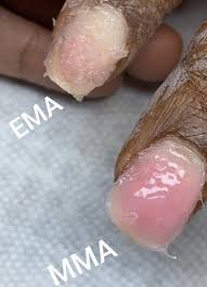Cas confirmés, mortalité, guérisons, toutes les statistiques The Dangers Of Cheap Mma Acrylic Nails
