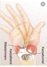 We did not find results for: Schmerzen Hand Innen Ballen Entzundung Gesundheit Und Medizin Gesundheit Sport Und Fitness
