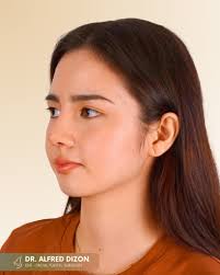 Finding the secret to a great face isn't about perfect features—it's about  facial harmony. 🍐 It's the natural balance and proportion between all your  features: your nose, lips, chin, and eyes all