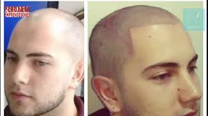 ENTREVISTA: ANA MARCOLLI DANIEL BRACCO