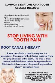 Pin On Dentistry