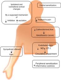 Complex Regional Pain Syndrome Crps A Review Sciencedirect
