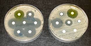 Maybe you would like to learn more about one of these? Antimicrobial Resistance Wikipedia