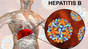 Bisakah Penyakit Hepatitis B Disembuhkan