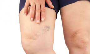 Varis Nedir Bilgi Ve Paylasim Alani Kadinlar Kulubu