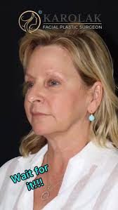 Elegantly refreshed! I recently had the pleasure of catching up with my  beautiful patient from #NewOrleans, one of my favorite cities !!!! At 59,  she had flown in to freshen up her appearance, but did ...