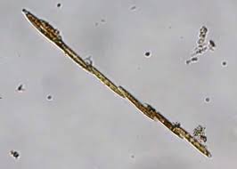 Image result for Entada bacillaris