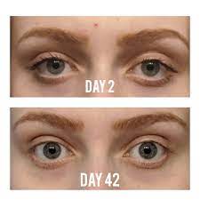Posted by 5 days ago. How My Eyes Have Changed Since Quitting Leaves