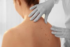 When malignant cancer cells form and grow within a person's breast tissue, breast cancer occurs. 3 Most Common Types Of Skin Cancer Blue Ridge Dermatology Associates Pa Blue Ridge Dermatology Associates Pa