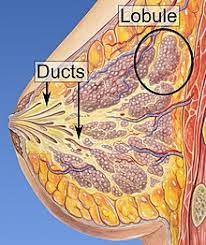 Due to metastasis, stage 4 cancer is usually not cured with surgery or radiotherapy, states oasis of hope. Breast Cancer Wikipedia