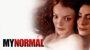 My Normal