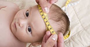 Hidrosefalus Pada Anak Operasi