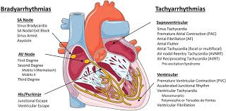 Cells | Free Full-Text | Mitochondrial Dysfunction In Cardiac Arrhythmias